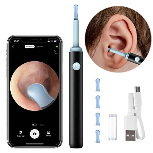 Smart Ear Wax Remover