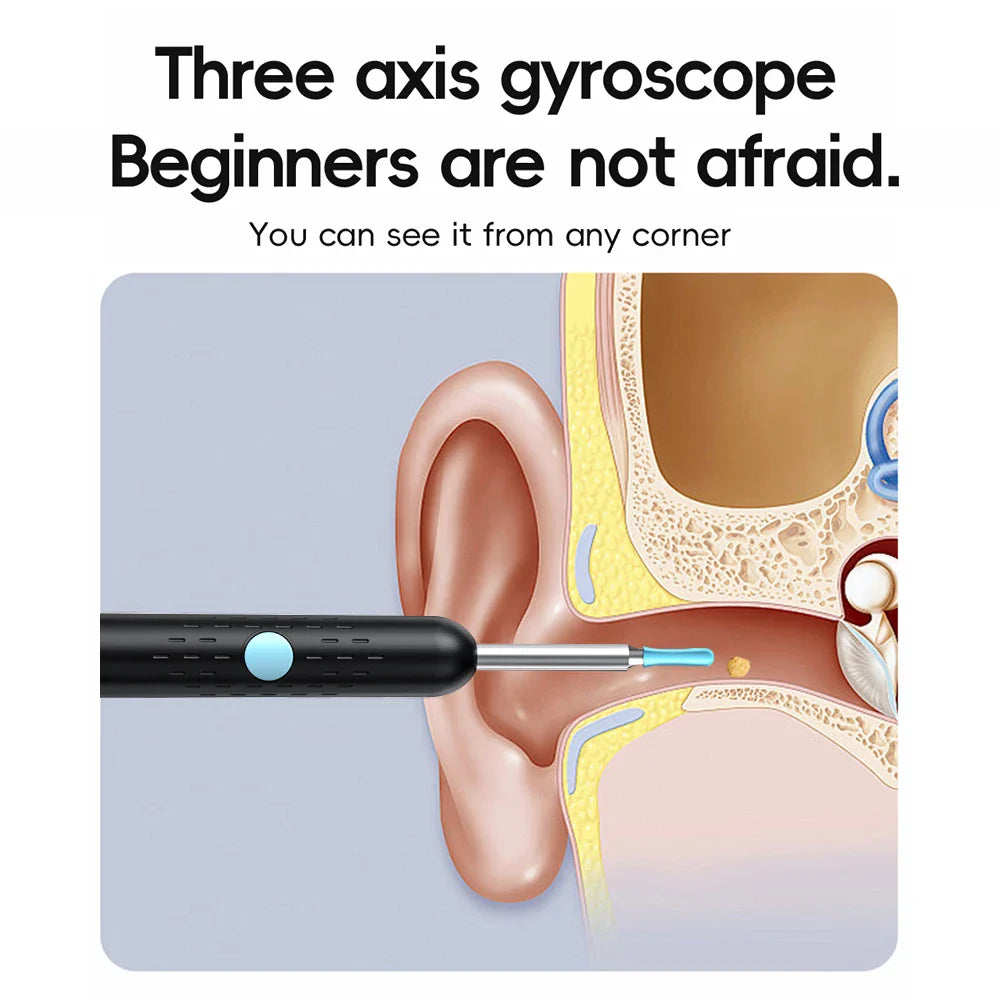 Smart Ear Wax Remover